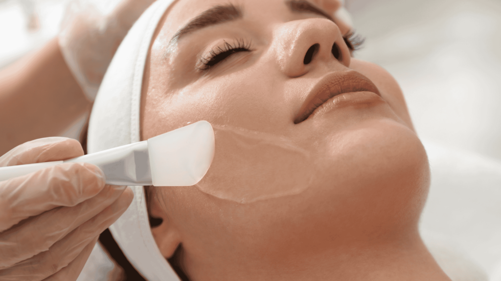 Peeling Químico | Dra. Camila Laranjo | Dermatologista
