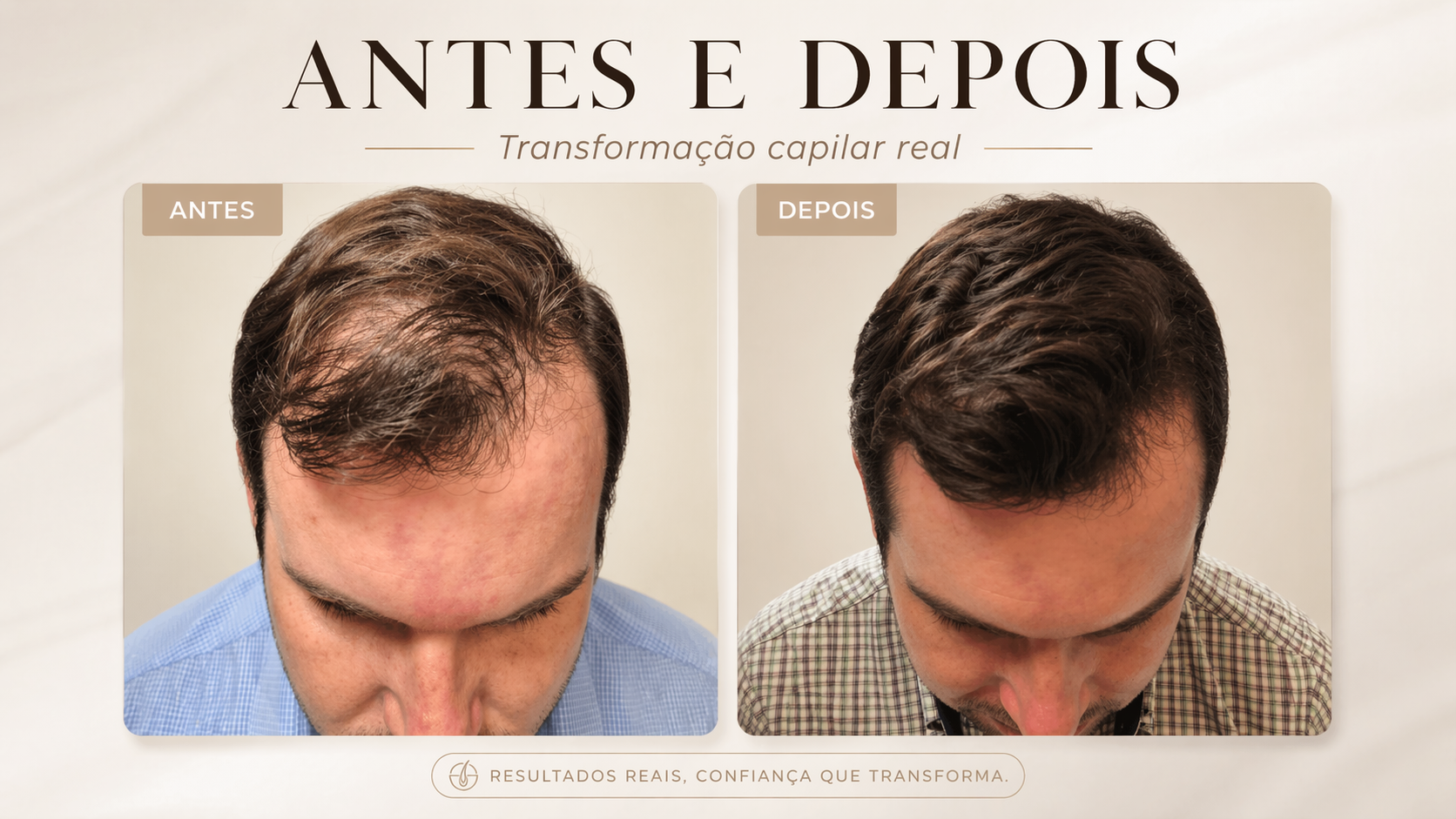 Resultado antes e depois